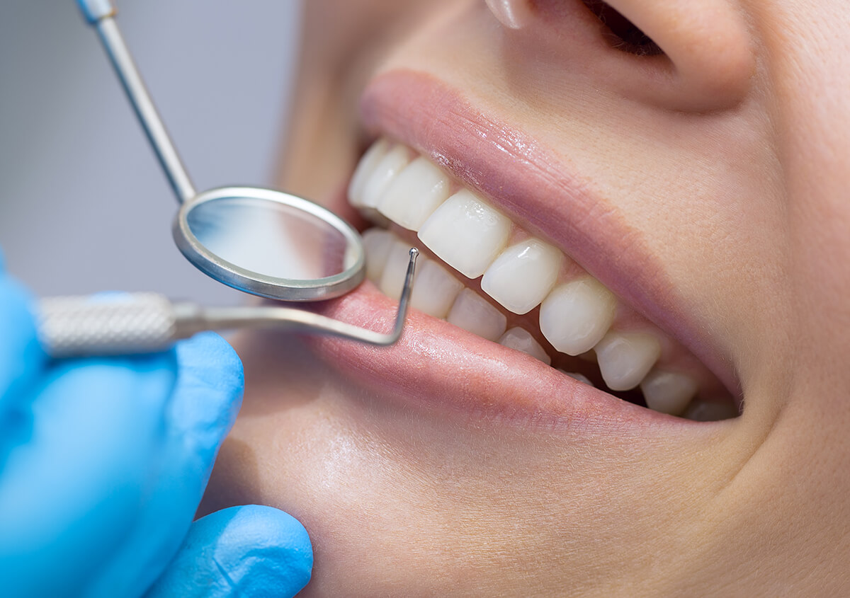 Long-term Benefits of Professional Dental Cleaning